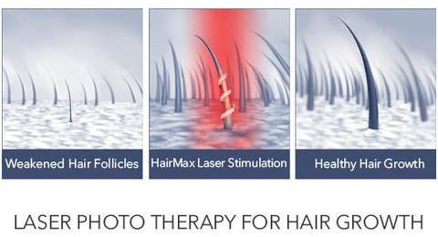 Are there any side effects to using HairMax Laser Devices?